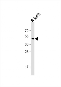 KCTD13 Antibody (C-term)