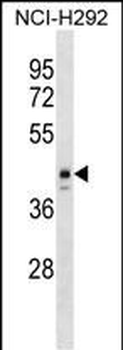 ESX1 Antibody (N-term)