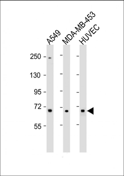 COL8A1 Antibody (N-term)