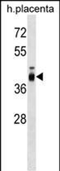 ZP3 Antibody (C-term)