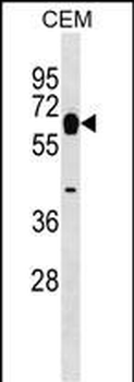 MYOT Antibody (Center)