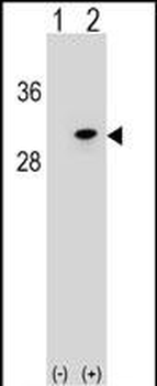 POLR2D Antibody (Center)