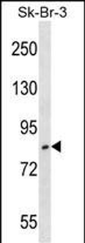 USP10 Antibody (Center)