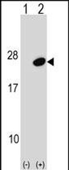 UBE2G1 Antibody (C-term)