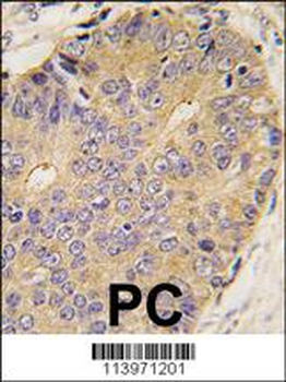 BMP15 Antibody (Center)