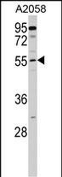CNDP2 Antibody (C-term)