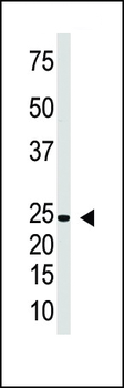 IL29 Antibody (Center)