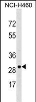 VDAC3 Antibody (Center)