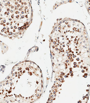 VDAC3 Antibody (Center)