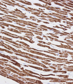 VDAC3 Antibody (Center)