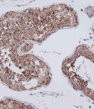 VDAC3 Antibody (Center)