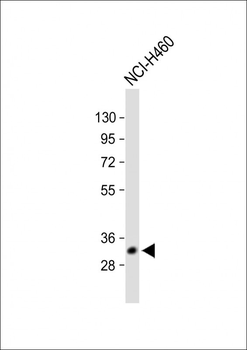 VDAC3 Antibody (Center)