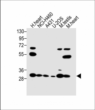 VDAC3 Antibody (Center)