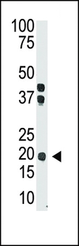 IL28 Antibody (Center)