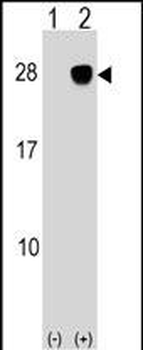 ULBP2 Antibody (Center)