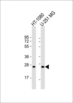 ULBP2 Antibody (Center)
