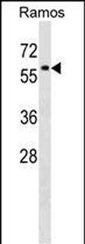 P4HA1 Antibody (C-term)
