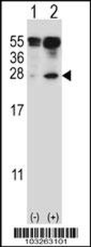 IL-17D Antibody (Center)
