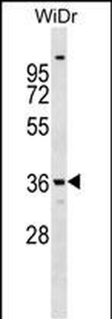 ANXA9 Antibody (Center)