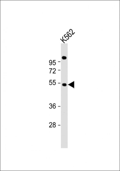 EIF2B3 Antibody (C-term)