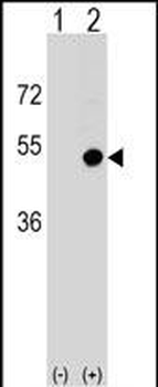 CD1D Antibody (Center)