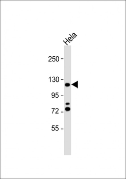 HIRA Antibody (N-term)