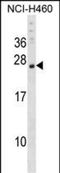 CSRP3 Antibody (Center)