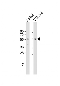 VIPR2 Antibody (N-term)