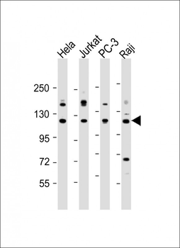 REST Antibody (Center)