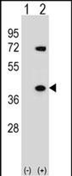 HNRNPA1 Antibody (C-term)