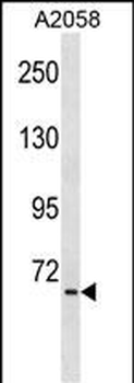 TNIP1 Antibody (C-term)