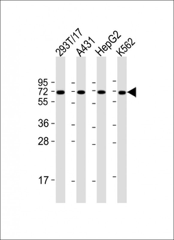F9 Antibody (Center)