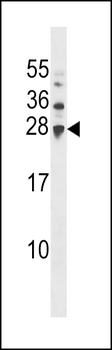 UBE2H Antibody (Center)
