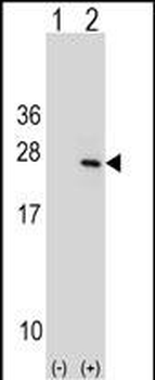 PTP4A1 Antibody (C-term)