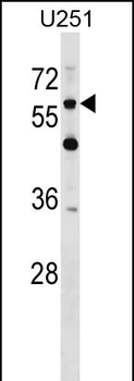 CSPG5 Antibody (C-term)