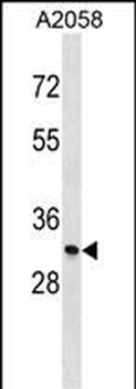 MGLL Antibody (N-term)