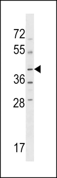 NPRL2 Antibody (C-term)