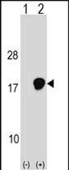 UBE2D3 Antibody (C-term)