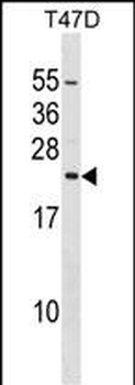 EIF3K Antibody (C-term)