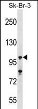 USP16 Antibody (N-term)