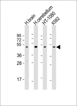 DRD2 Antibody (C-term)