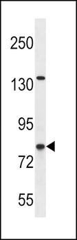 CPT1B Antibody (C-term)