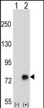 TGFBI Antibody (N-term)