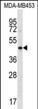 HAPLN3 Antibody (Center)