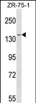 PAN2 Antibody (C-term)