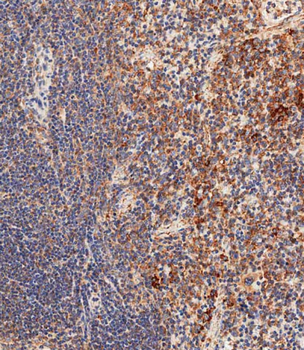 Mouse Nlrp6 Antibody (Center)