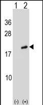 ARL2 Antibody (Center)