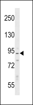 PPP1R9B Antibody (N-term)