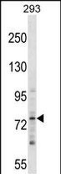 ZNF81 Antibody (N-term)