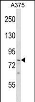 PHF21A Antibody (Center)